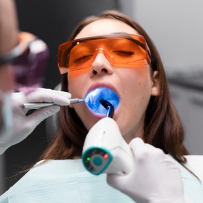 Шинирование зубов светоотверждаемым материалом в переделах 6-ти зубов