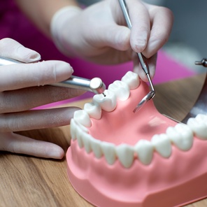 Металлопластмассовая коронка