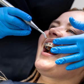 Пластинка с двумя рекообразными пружинками, два кламера Адамса