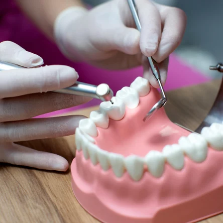 Металлопластмассовая коронка