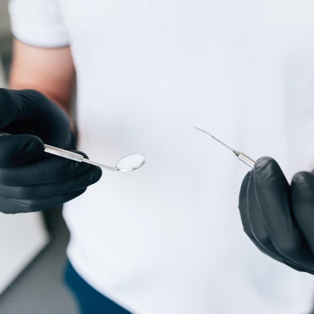 Снятие зубных отложений