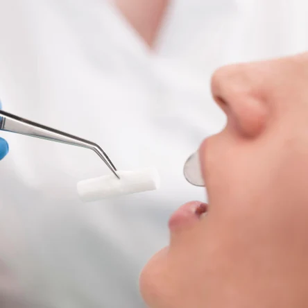 Распломбировка канала