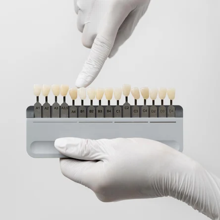 Металлическая коронка с пластмассовой облицовкой