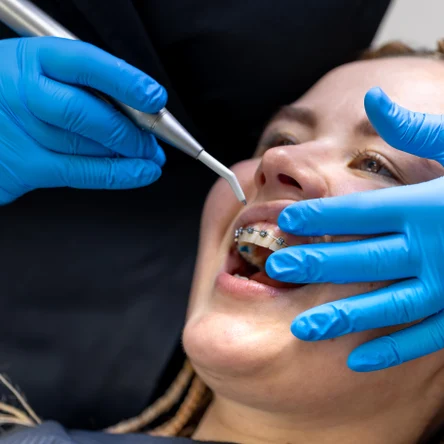 Пластинка с двумя рекообразными пружинками, два кламера Адамса